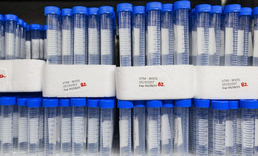 Conical tubes stacked in foam holders awaiting testing.